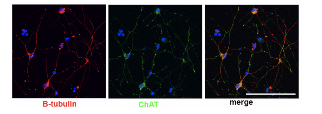 Front.Aging neurosci-基底前脑胆碱能<font color="red">神经</font>元：关联唐氏<font color="red">综合症</font>和阿尔茨海默<font color="red">病</font>