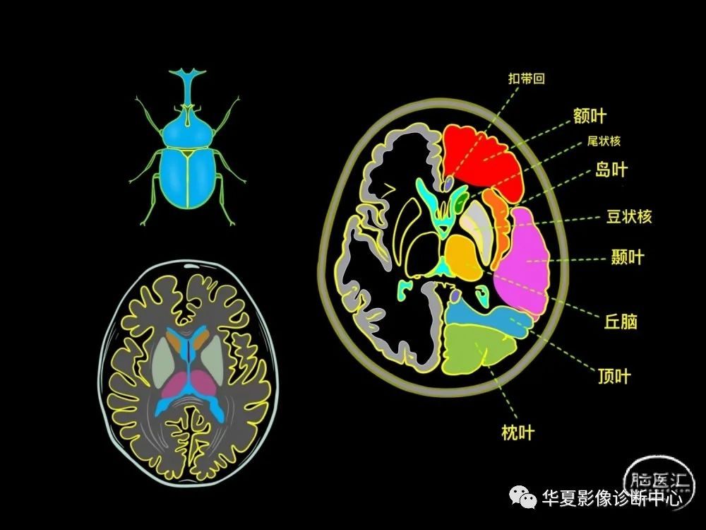 （手绘·图文）脑部影像诊断“七层颅脑”形象记忆法
