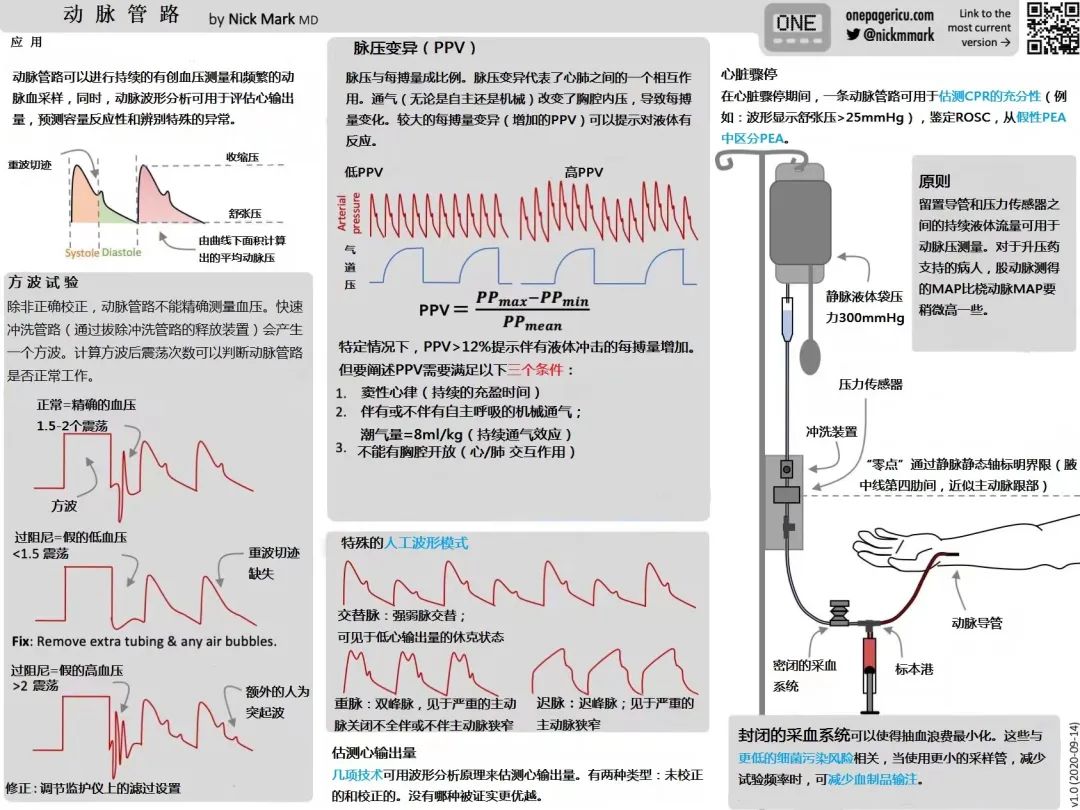 重症卡片：有创动脉压监测