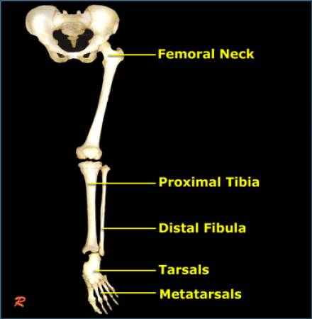 应力性骨折影像学特征及常见位置！总结归纳！