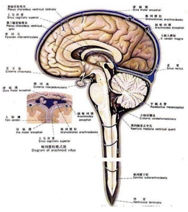 大脑纵裂和小脑幕高密度，您还诊断为蛛网膜<font color="red">下</font>腔出血吗？