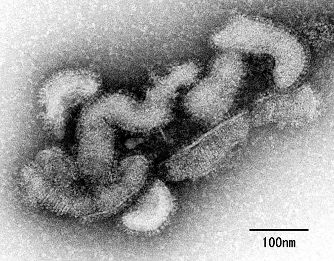 全球首例！日本一女性被蜱虫咬伤后感染Oz病毒死亡