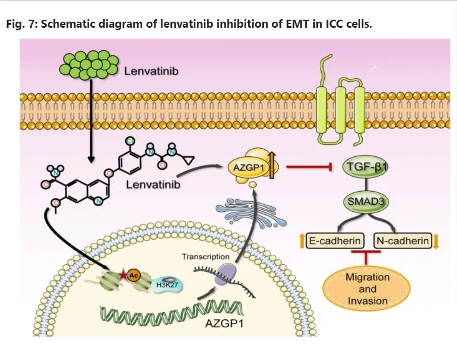 CDD：AZGP1可能是仑伐替尼治疗肝内胆管癌的新靶点