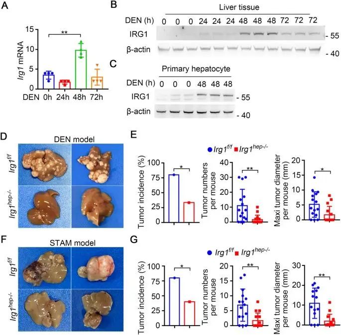 CDD：曹雪涛团队发现可诱导线粒体IRG1促进肝细胞凋亡和随后的肝癌发生