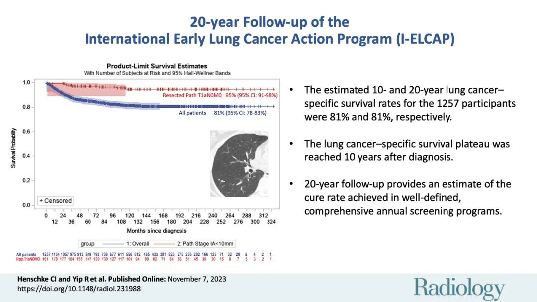 Radiology：低剂量CT筛查肺癌价值巨大，20<font color="red">年生存</font>率高达81%！