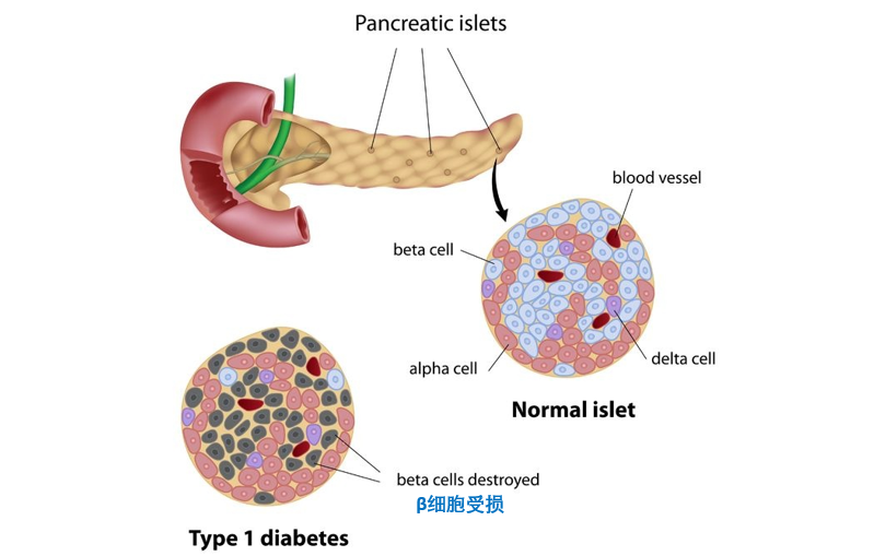 胰腺泡心细胞图片图片