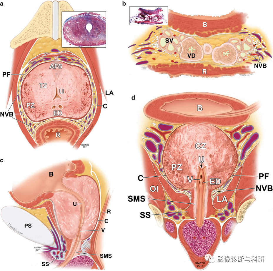 影像解剖| 前列腺解剖分区及MR表现@MedSci