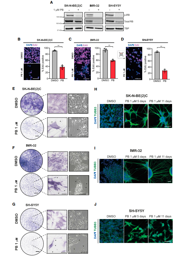 Dev Cell：哌柏西利显著提高神经母细胞瘤分化，有望改善现有疗法