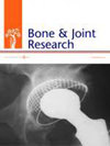 BONE JOINT RES