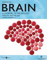 BRAIN BRAIN