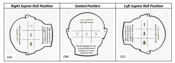 【Guidelines for reasonable and appropriate care in the emergency department 3 (GRACE-3): Acute dizziness and vertigo in the emergency department】Vestibular diagnostic diagram
