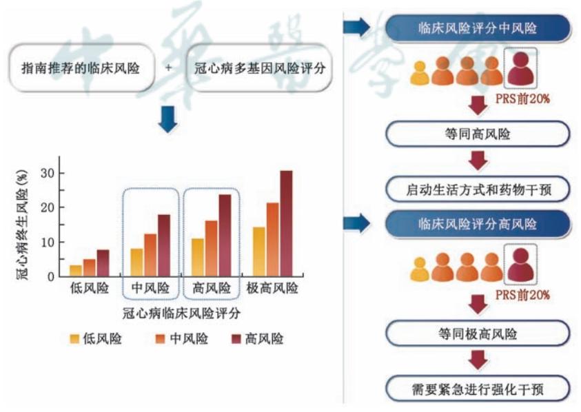 【遗传检测与冠心病风险评估中国专家共识】冠心病患者PRS危险分层及干预策略