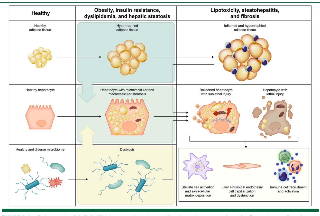 【AASLD Practice Statement on the evaluation and management of metabolic dysfunction-associated steatotic liver disease in children】Pathogenesis diagram