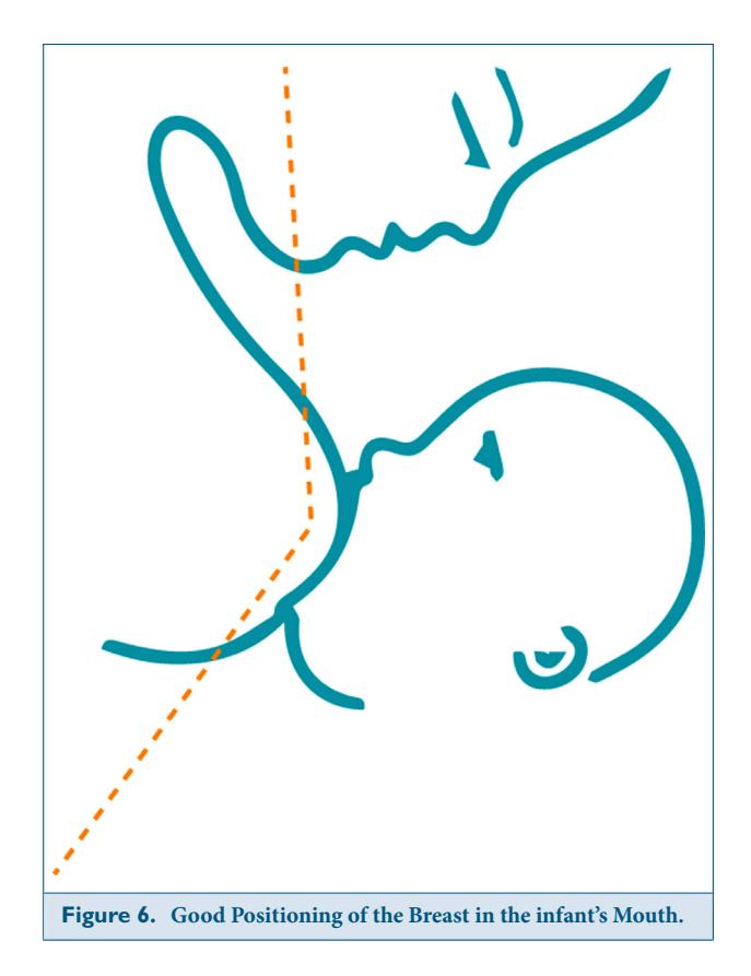 【Initiating and Supporting Breastfeeding: Guidelines forInterventions during the Perinatal Period from the FrenchNational College of Midwives】Breastfeeding positioning diagram