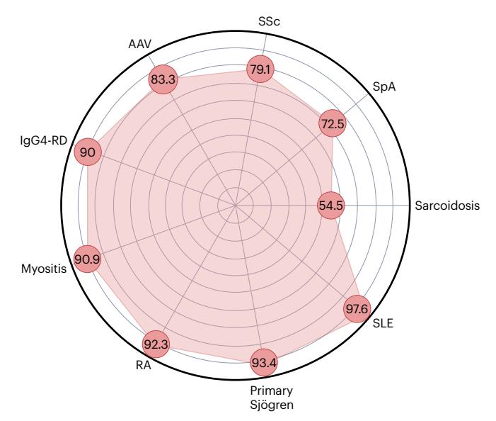 【2023 International Rome consensus for the nomenclature of Sjögren disease】Radar chart