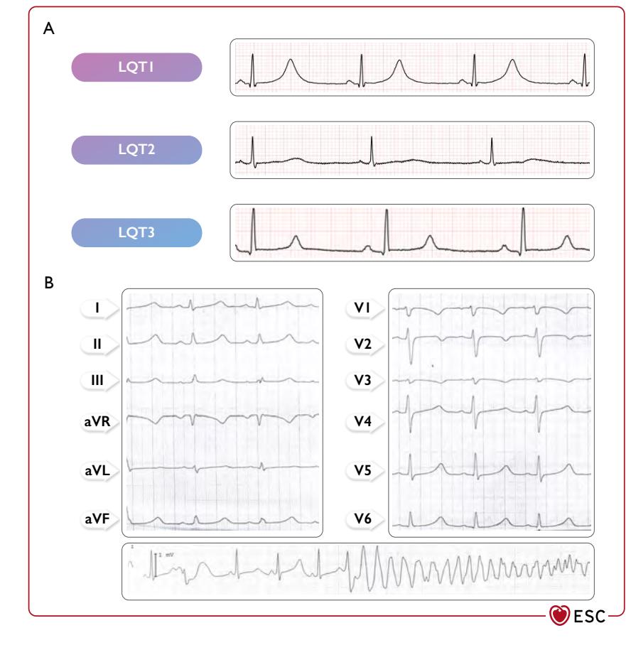 image_category: CLINICAL_PHOTO/Electrocardiogram |...
