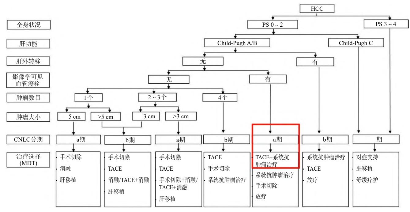 【《原发性肝癌诊疗指南(2024年版)》要点解读】肝癌诊疗指南流程图