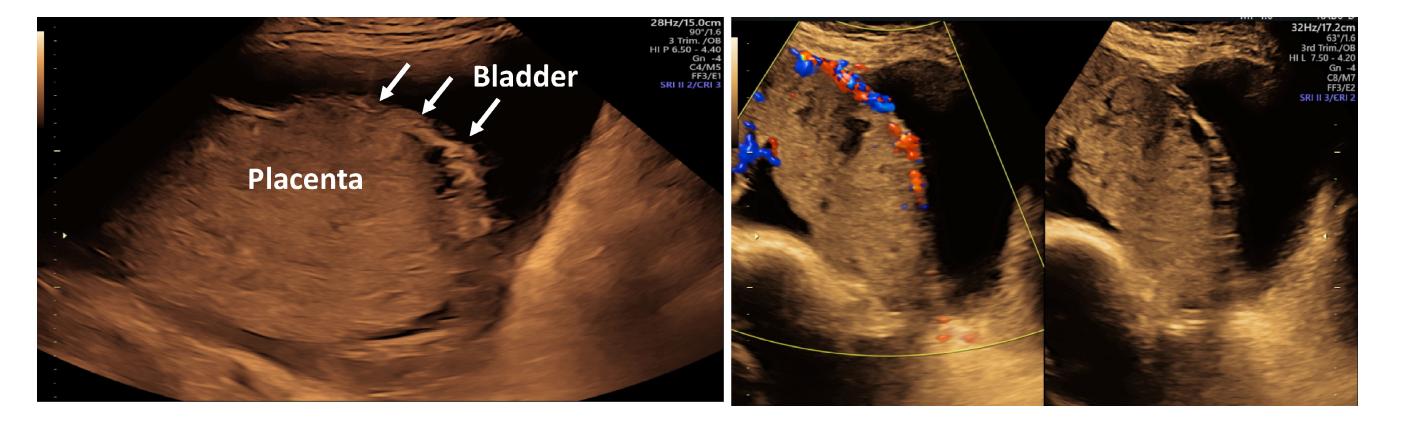 【ISUOG Practice Guidelines: performance of third-trimester obstetric ultrasound scan】Obstetric Ultrasound