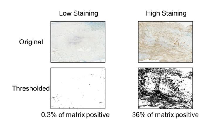【Histological and immunohistochemical guide to tendon tissue】Immunohistochemistry (IHC) image analysis