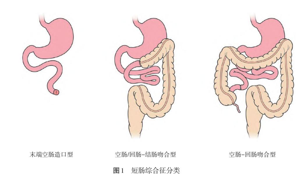 【解剖示意图】body...
