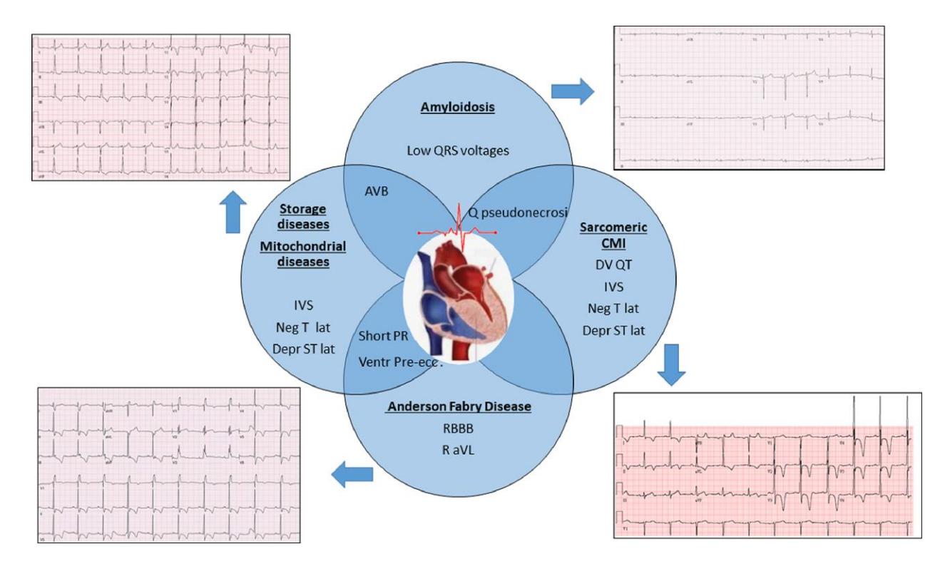 DIAGRAM/ECG diagnostic diagram