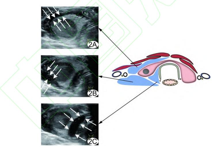 image_category: MEDICAL_IMAGING/超声影像与解剖示意图
