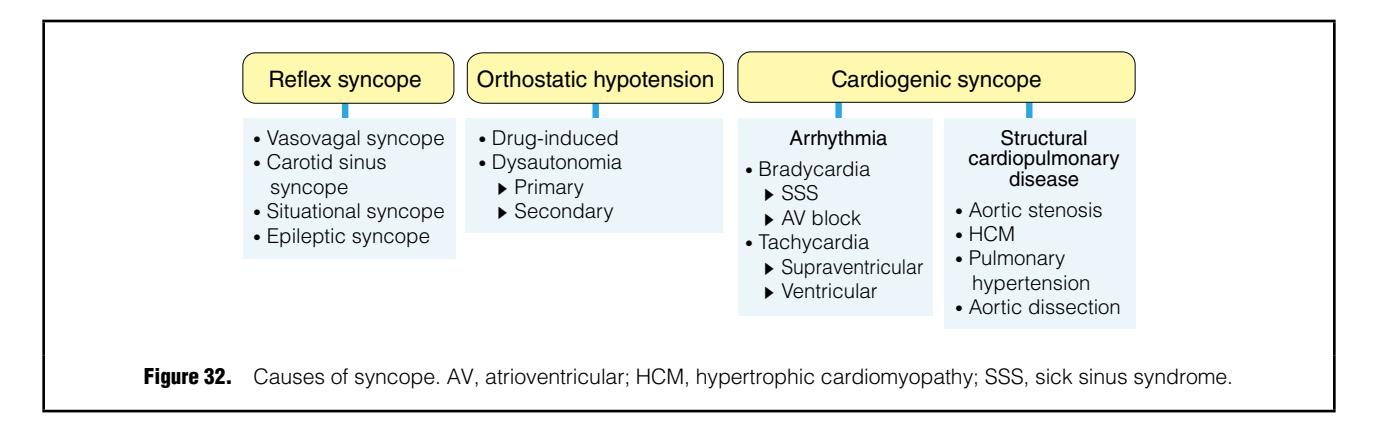 【JCS/JHRS 2022 Guideline on Diagnosis and Risk Assessment of Arrhythmia】Syncope classification chart