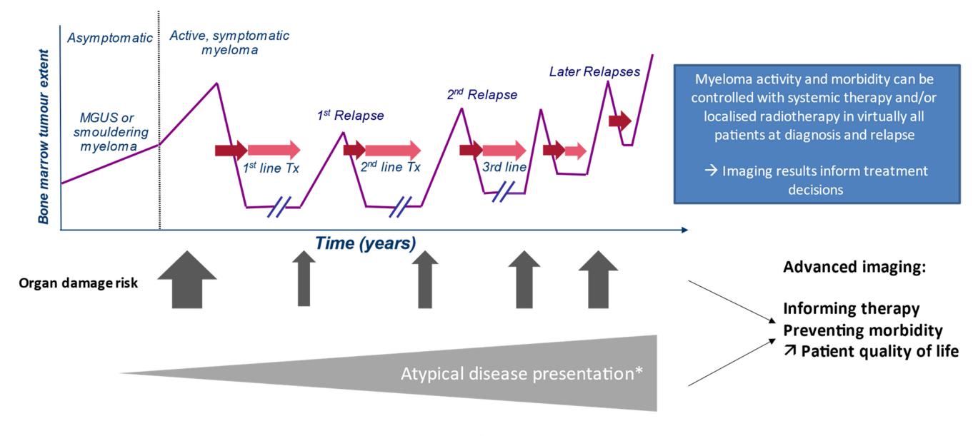【British Society of Haematology and UK Myeloma Society Good Practice Paper】Disease progression diagram of multiple myeloma