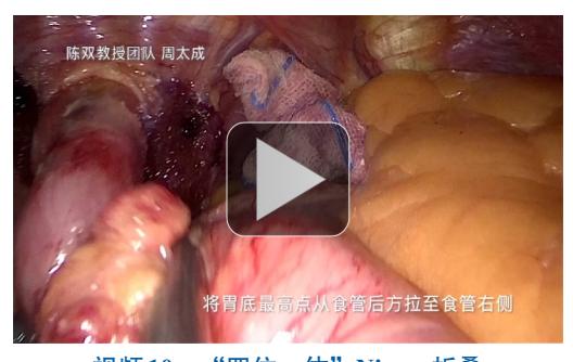 【食管裂孔疝及胃食管反流病规范化腹腔镜手术七步法操作指南(2025版)】腹腔镜手术影像