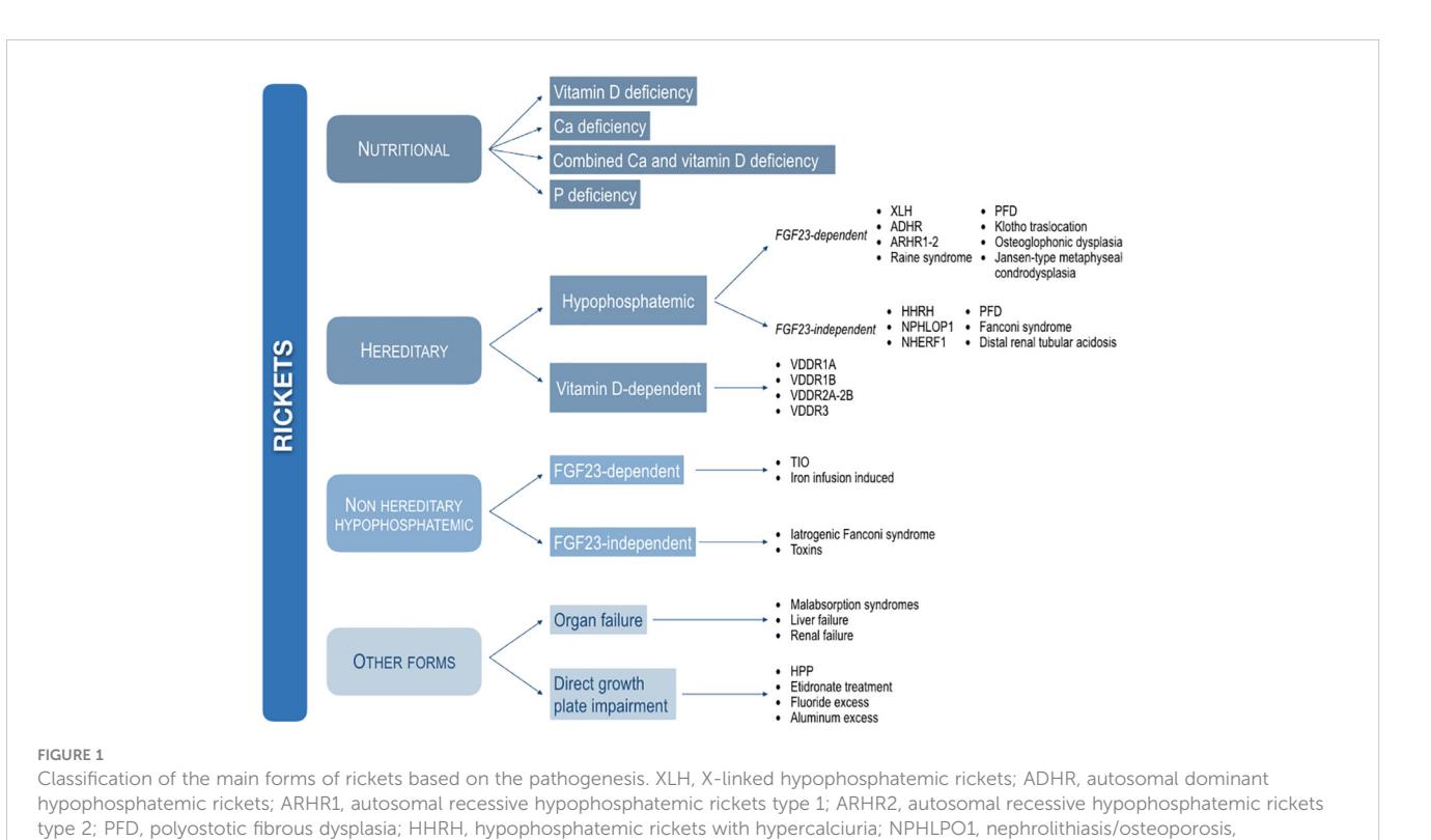 【Diagnosis, treatment, and management of rickets: a position statement from the Bone and Mineral Metabolism Group of the Italian Society of Pediatric Endocrinology and Diabetology】Diagnostic algorithm for rickets