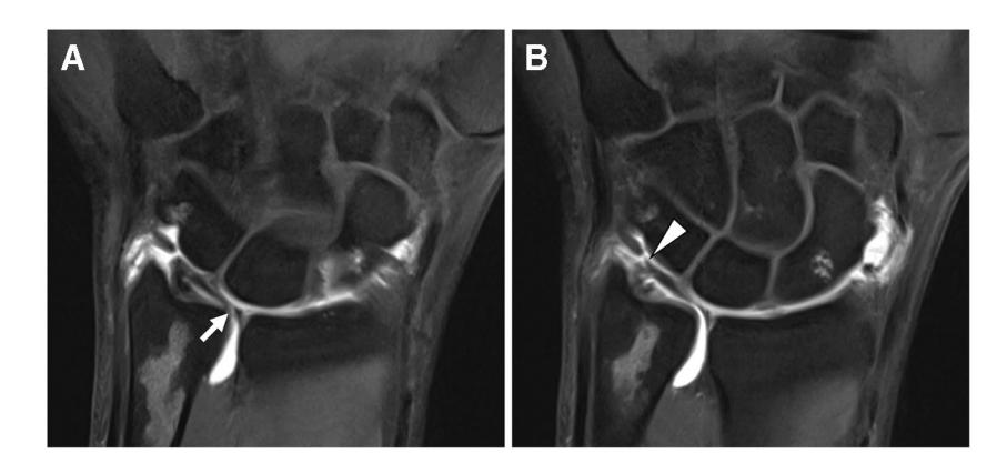【SSR white paper: guidelines for utilization and performance of direct MR arthrography】X-ray and MRI
