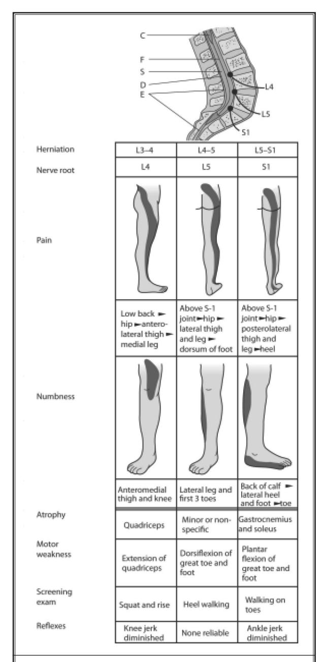 【ASIPP Guideline】Lumbar Disc Herniation Diagnostic Chart