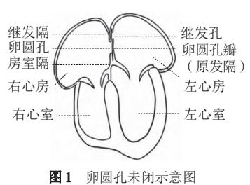 【卵圆孔未闭超声诊断中国专家共识】心脏解剖示意图