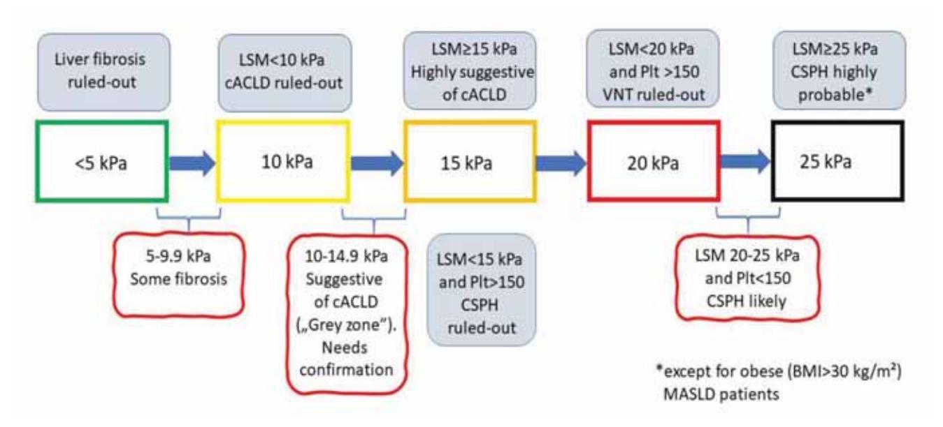 【克罗地亚门静脉高压症诊断和治疗指南】Rule of five by transient elastography