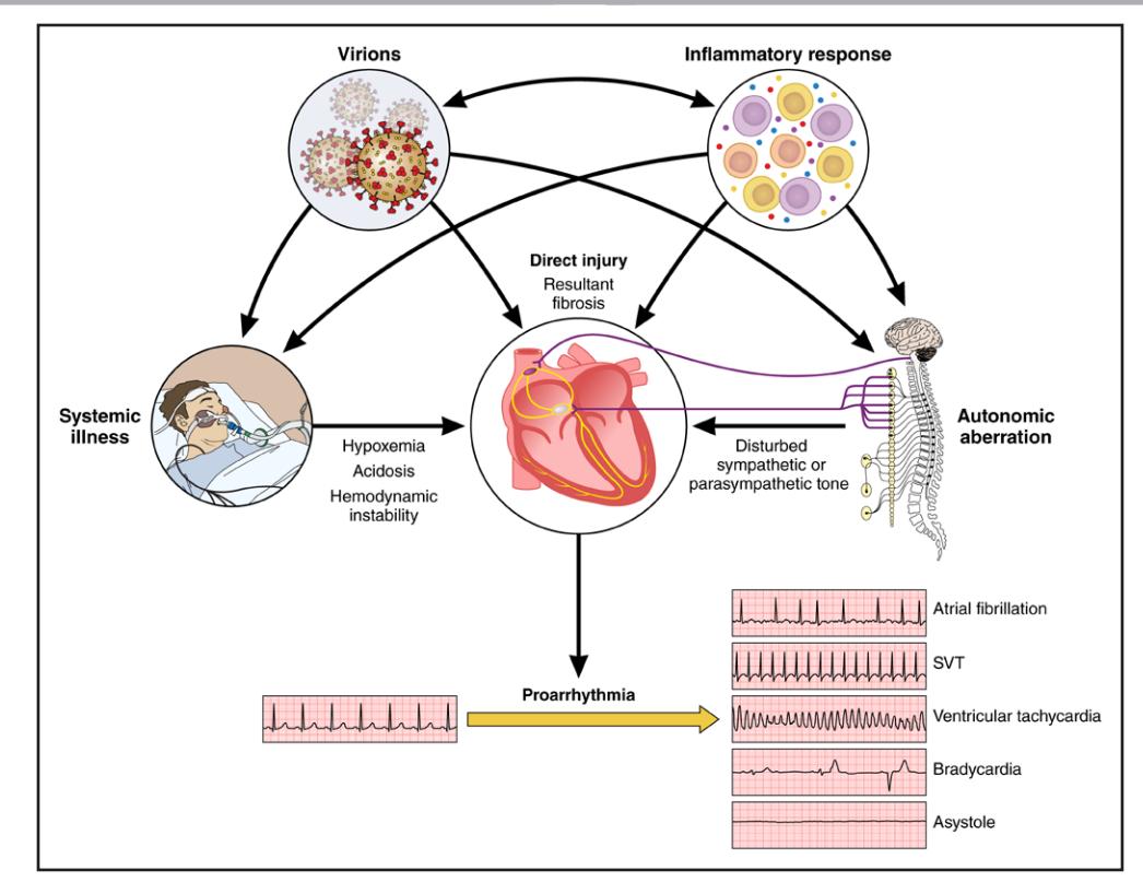 image_category: FLOWCHART/Pathophysiology diagram ...