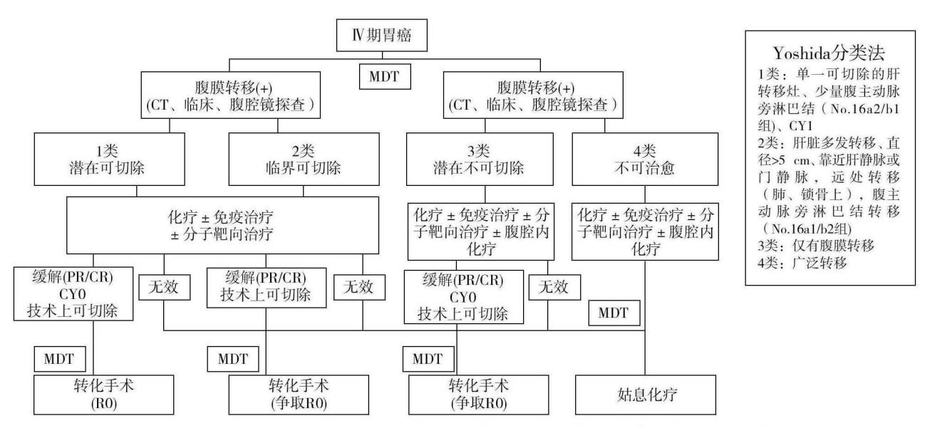 胃癌手术种类分型