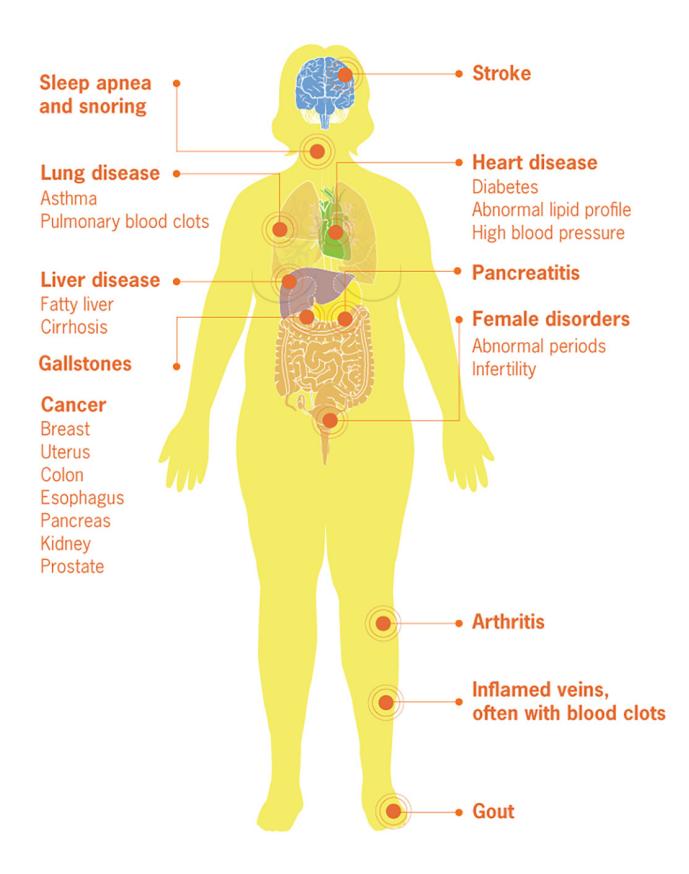 【Management of obesity across women's life course: FIGO Best Practice Advice】Medical Infographic