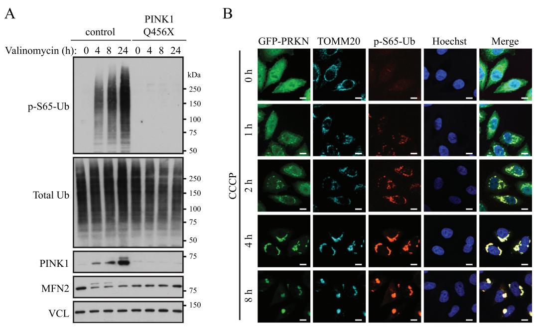 【自噬监测方法的使用和解释指南(第 4 版) 】Western Blot and Immunofluorescence