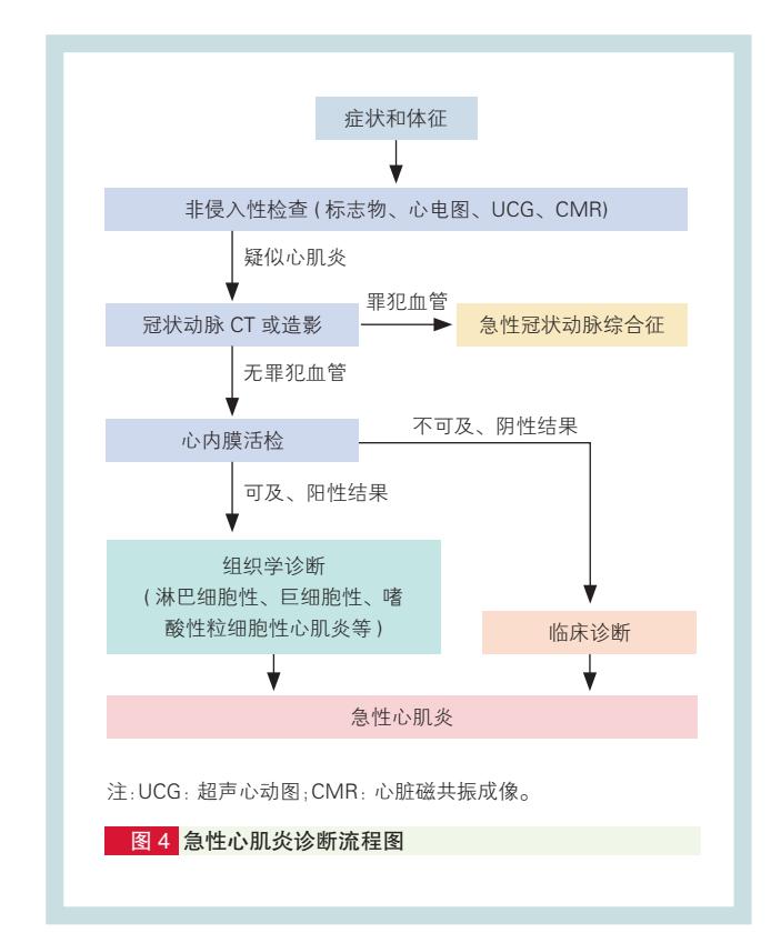 【急性心肌炎诊断流程图】