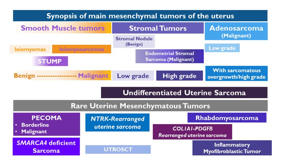 【Uterine sarcomas and rare uterine mesenchymal tumors with malignant potential. Diagnostic guidelines of the French Sarcoma Group and the Rare Gynecological Tumors Group】Classification diagram