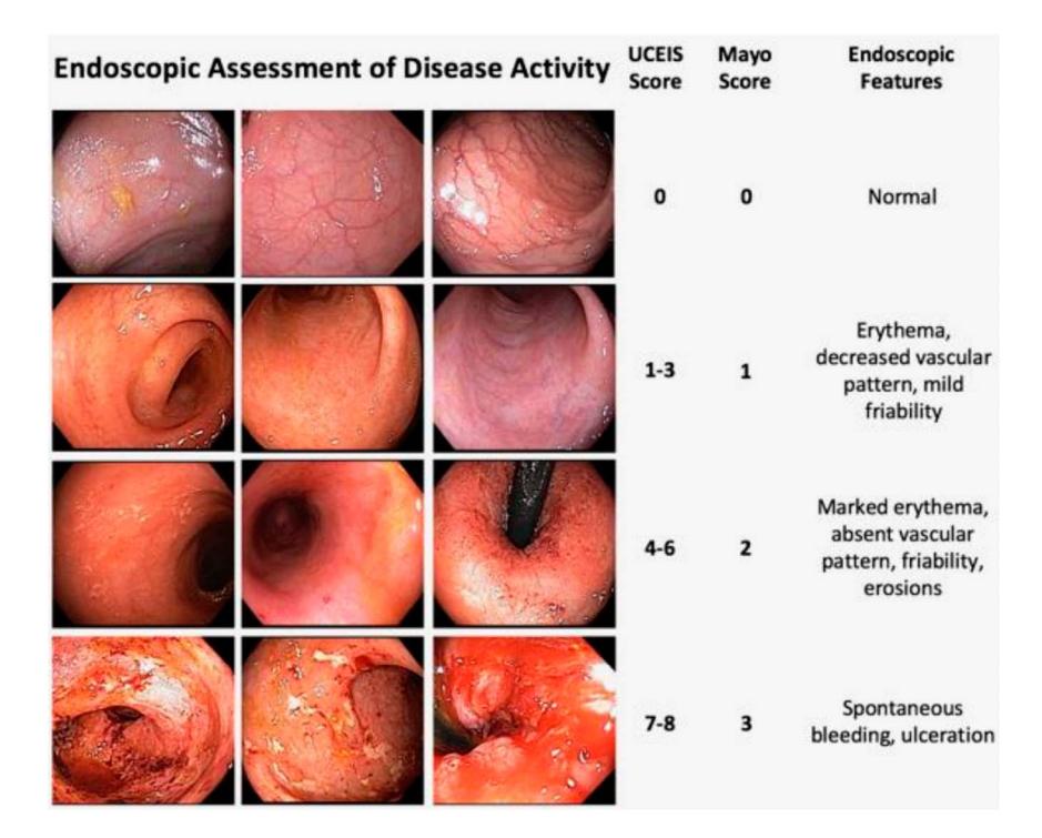 【UCEIS and Mayo Endoscopic Score Comparison】UCEIS and Mayo Endoscopic Score Comparison for UC