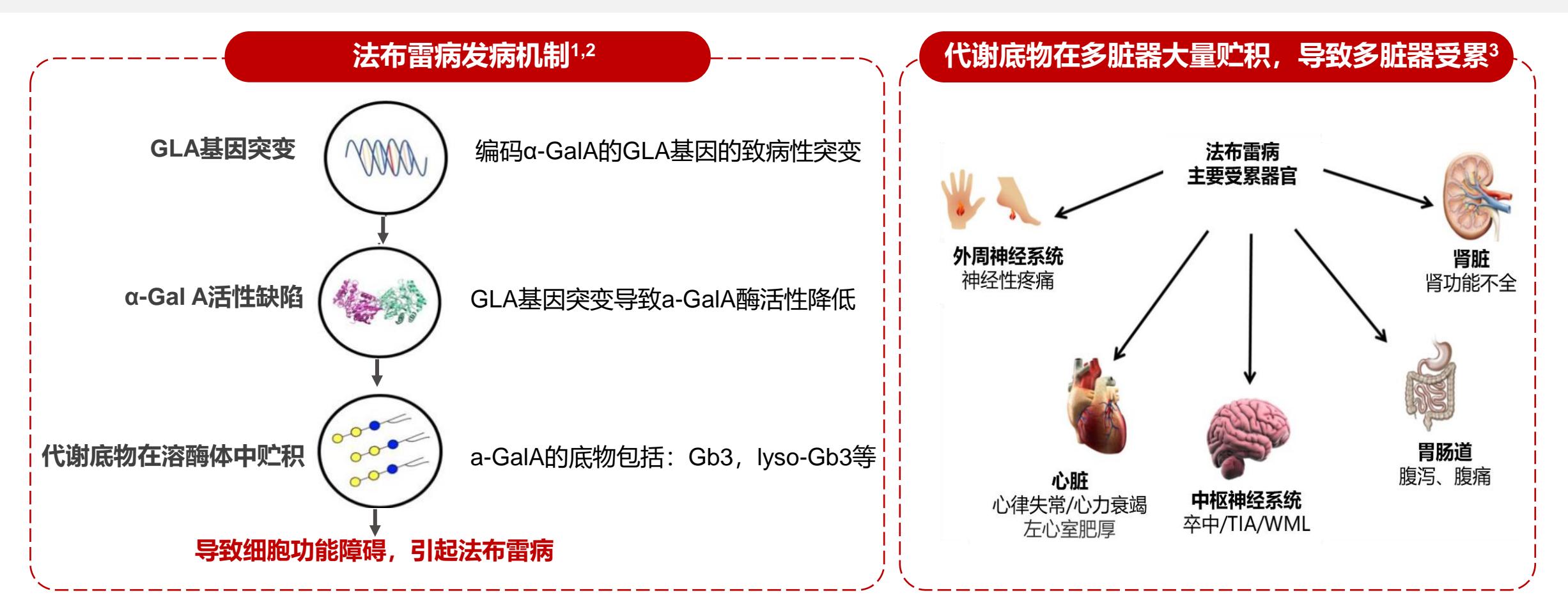 【从共识看对称性-肥厚型心肌病-鉴别诊断--《成人法布雷病心肌病诊断和治疗中国专家共识》 解读】从共识看对称性-肥厚型心肌病-鉴别诊断--《成人法布雷病心肌病诊断和治疗中国专家共识》 解读