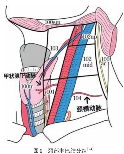 image_category: DIAGRAM/颈部淋巴结解剖分区示意图 | body_region: 头 | specialty: 头颈外科 | summary: 该图展示了颈部淋巴结的详细解剖分区及其与颈部大血管、甲状腺等器官的空间毗邻关系。