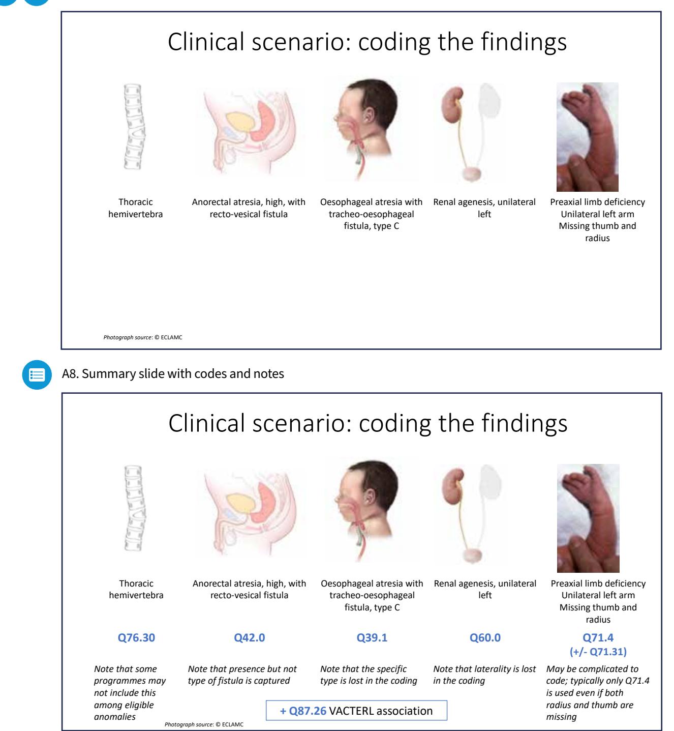 【Birth defects surveillance training】Educational slide