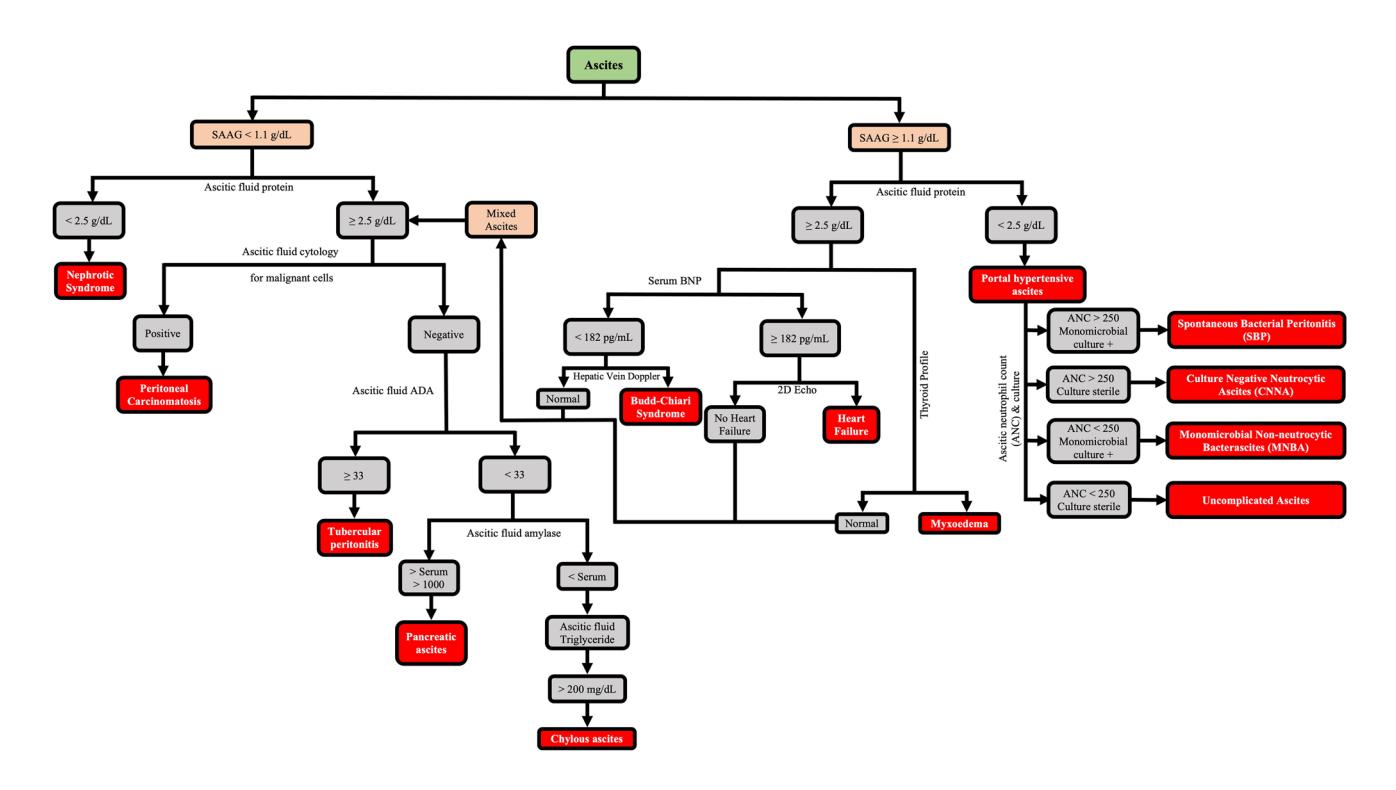 【腹水病因诊断流程图】Diagnostic Algorithm for Ascites