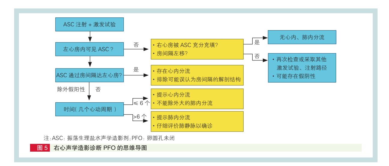 【卵圆孔未闭右心声学造影中国专家共识】诊断流程图