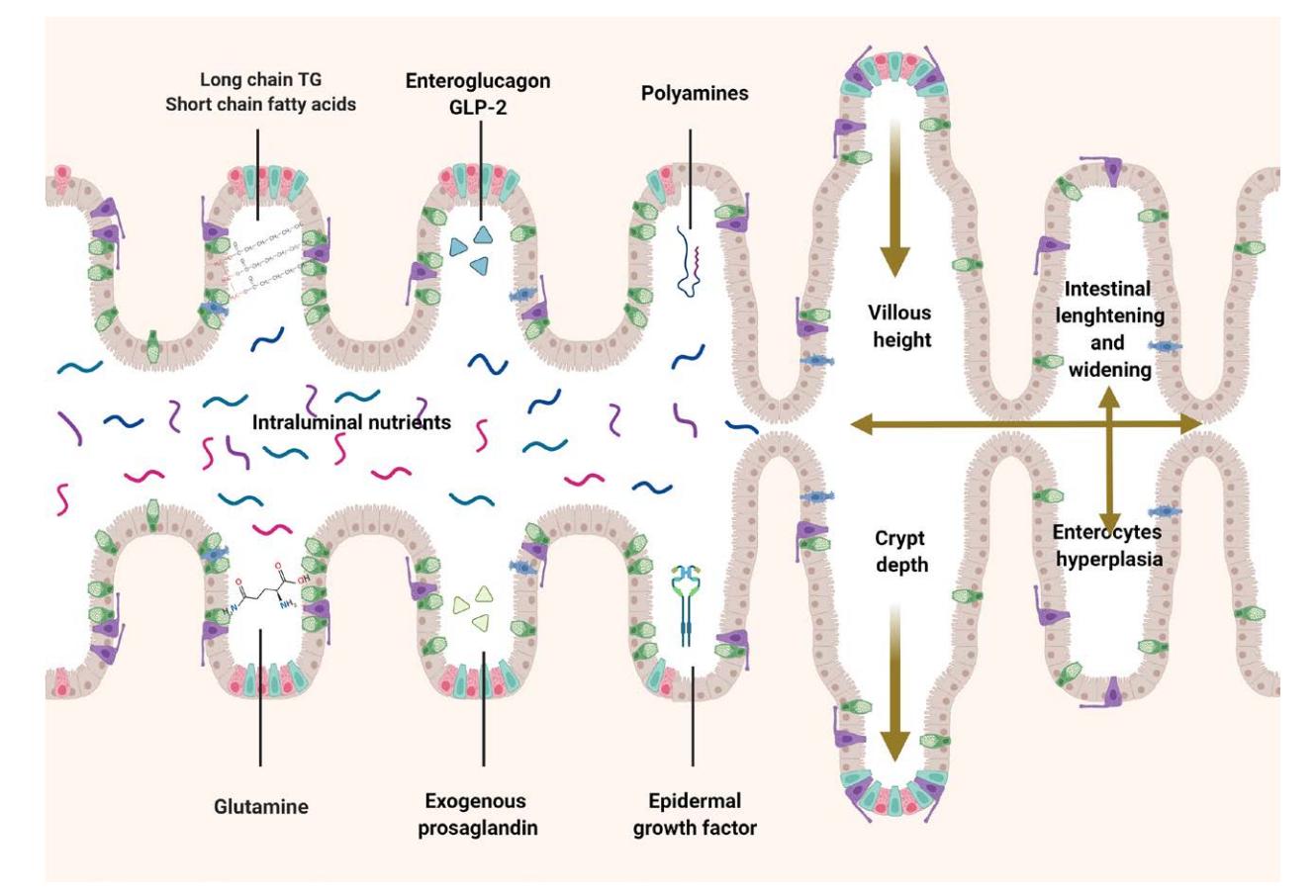 【Nutrition and Intestinal Rehabilitation of Children With Short Bowel Syndrome: A Position Paper of the ESPGHAN Committee on Nutrition. Part 1: From Intestinal Resection to Home Discharge】Medical Illustration of Intestinal Adaptation