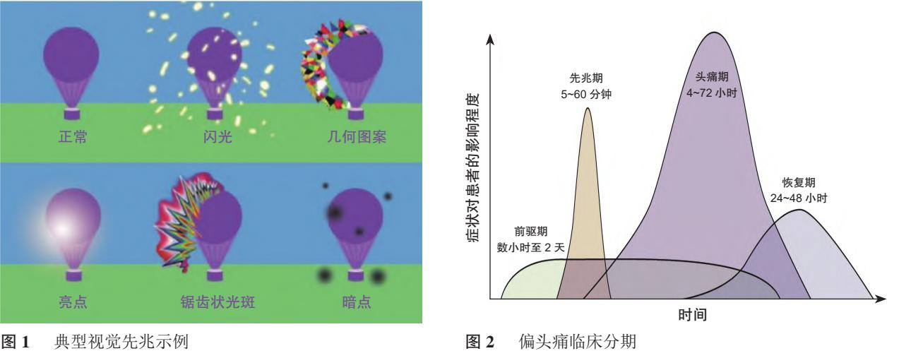 image_category: CHART_GRAPH/医学示意图与临床分期曲线图 | body_region: 头 | specialty: 神经内科 | summary: 展示了偏头痛典型的视觉先兆表现及其发作的四个临床阶段的时间分布特征。