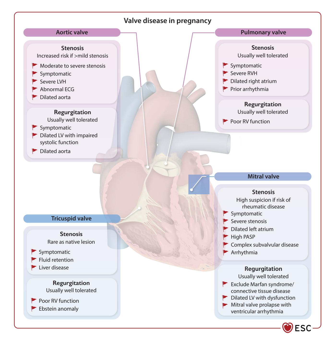 【ESC Guidelines】Valve Disease in Pregnancy Risk Infographic