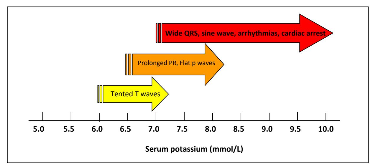 【UKKA】ECG changes in hyperkalemia diagram